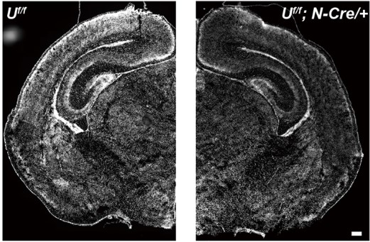 Fine-tuning of mTOR signaling by the UBE4B-KLHL22 E3 ubiquitin ligase cascade in brain development